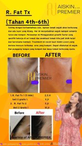 WhatsApp Image 2025-08-19 at 21.24.23 (13)